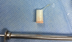 A Whistle Removed from Child Trachea at Uhud Hospital in Madinah