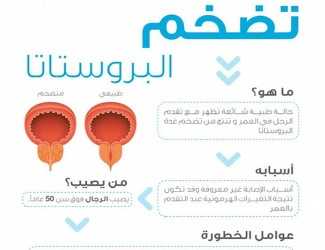 (الصحة) تفعِّل أنشطة اليوم العالمي لصحة الرجل 