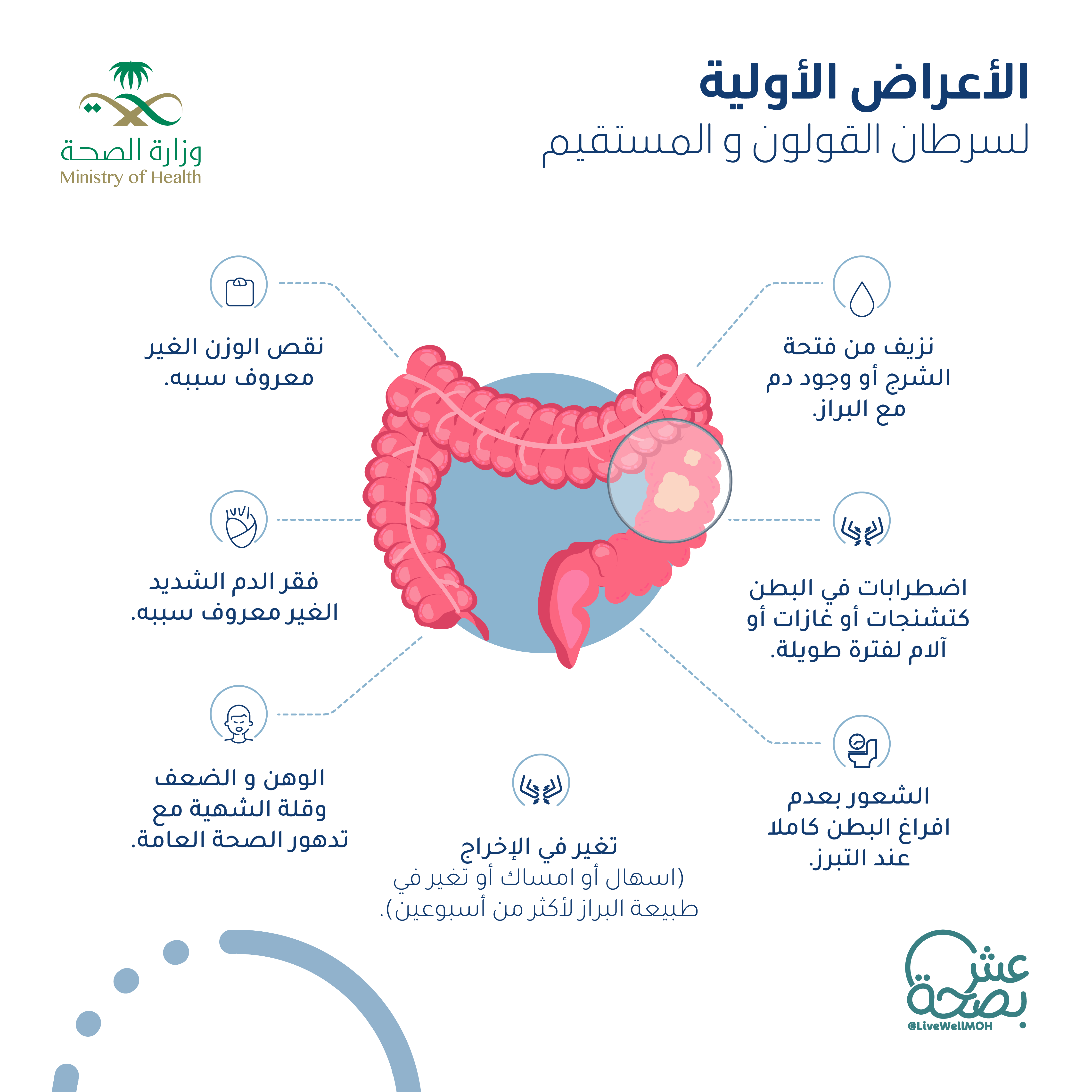 أعراض سرطان القولون المبكر