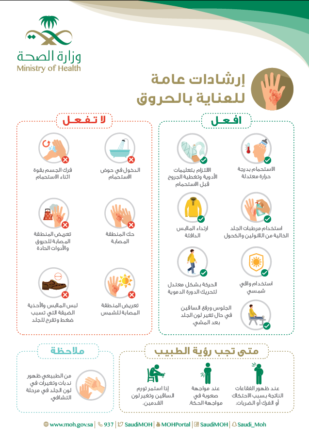 ارشادات عامة للعناية بالحروق