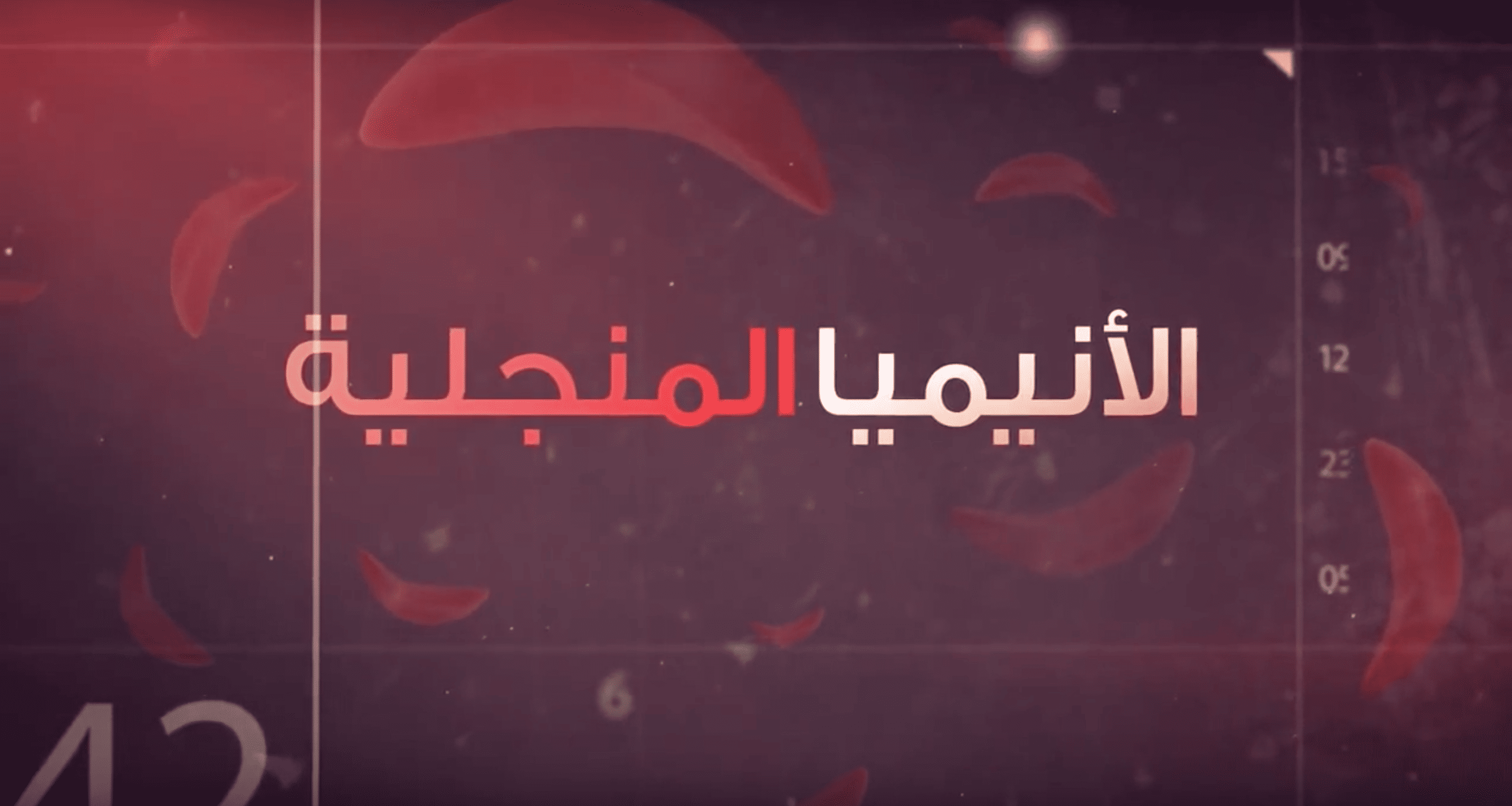 انيميا الخلايا المنجلية 