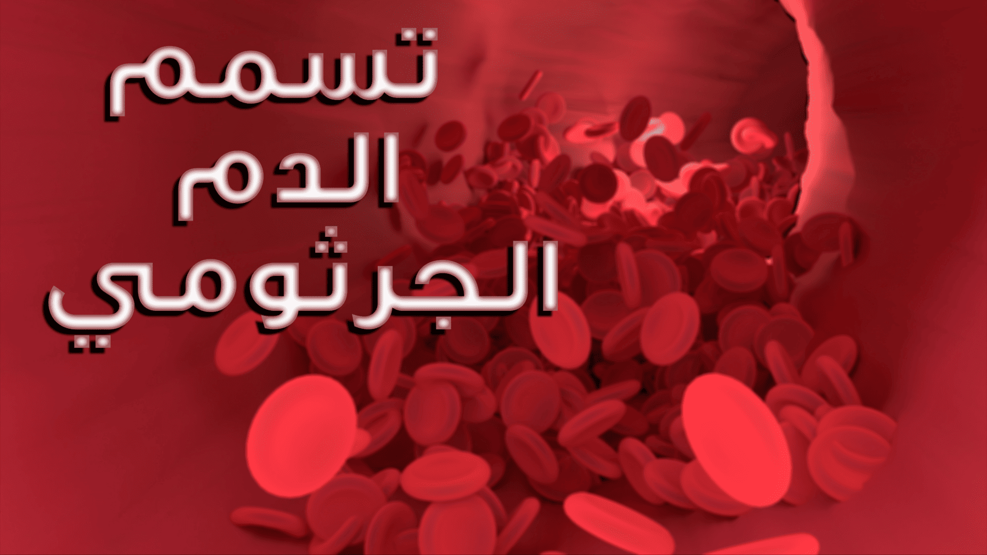 كم حالة تصاب بتسمم الدم في العالم سنويًا ؟ 