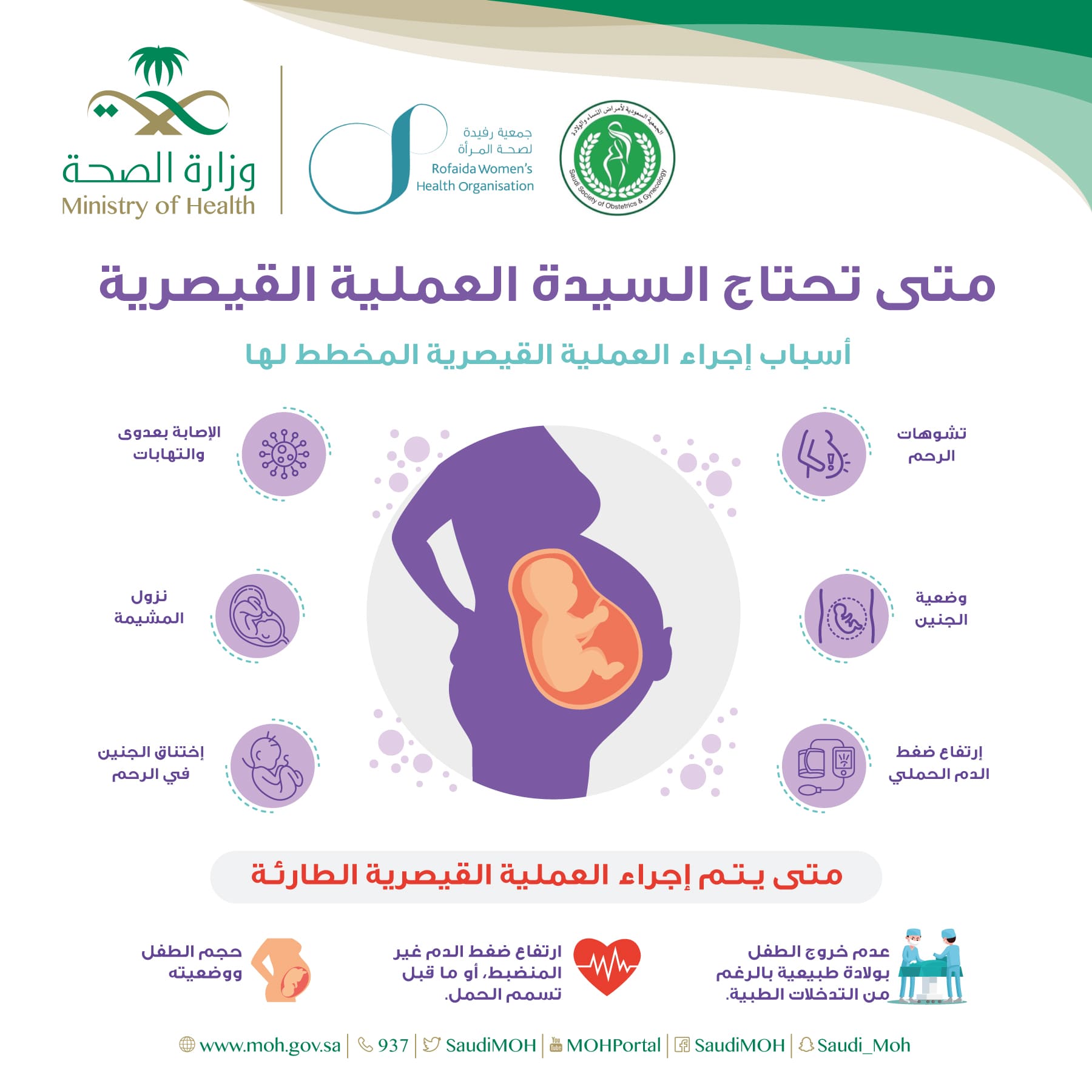 ماذا تعرفين عن قص العجان ؟ 