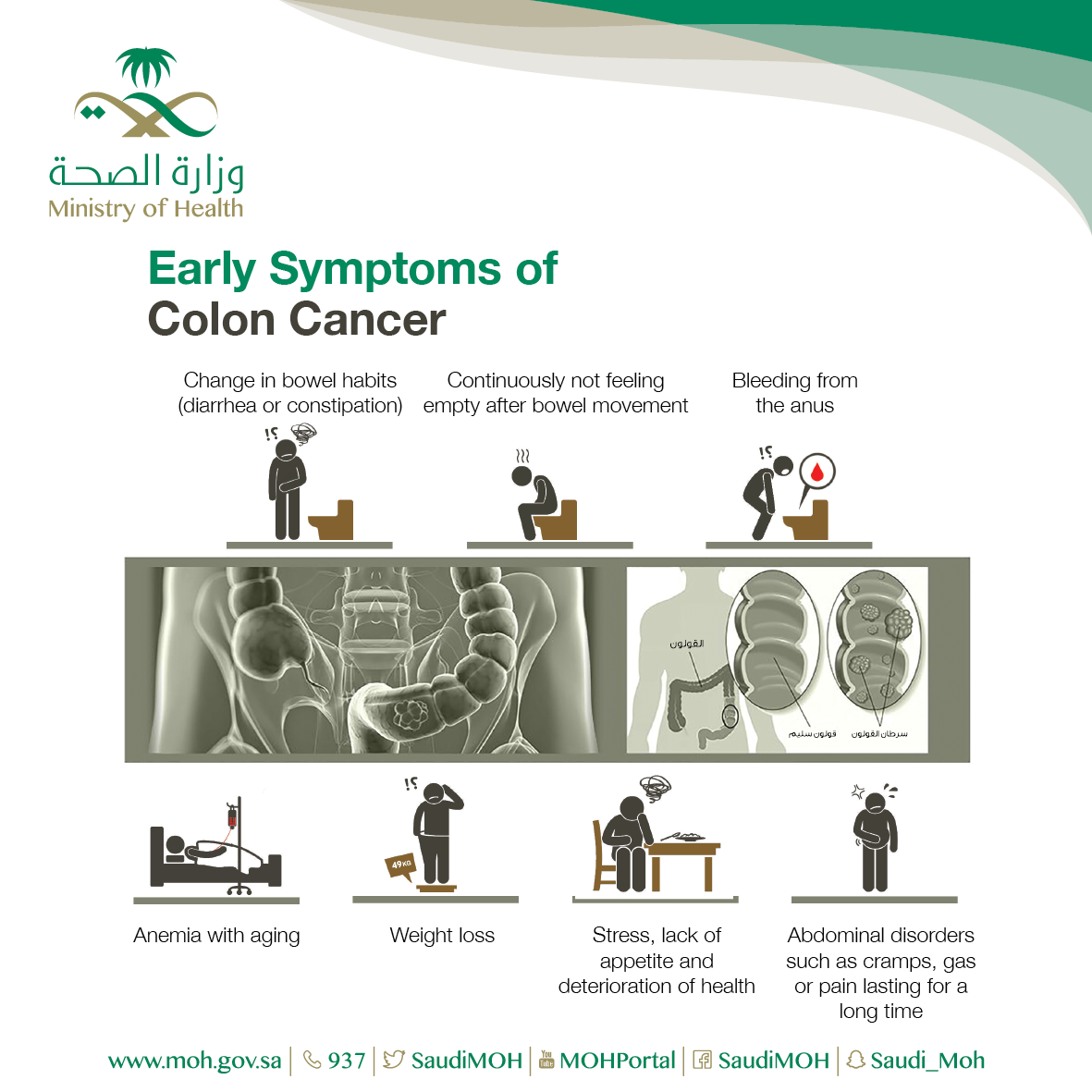 Early Symptoms of Colorectal Cancer